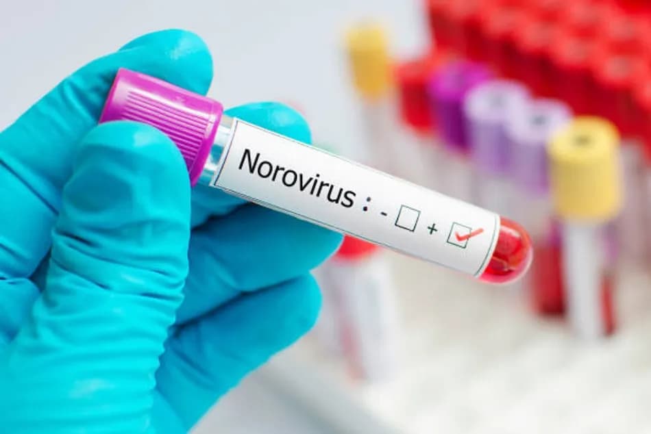 Norovirüs nedir ve Fransa’daki kruvaziyer gemisinde ne yaşandı