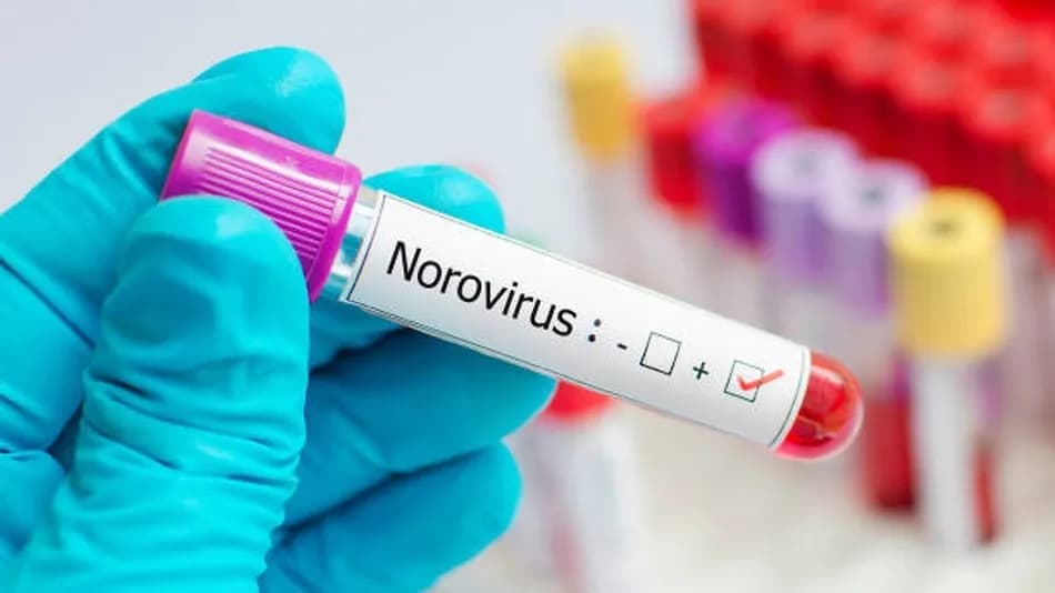 Norovirüs nedir ve Fransa’daki kruvaziyer gemisinde ne yaşandı