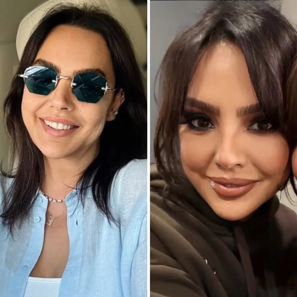 Ebru Gündeş yarım yüz gerdirme ameliyatı olduğunu açıkladı