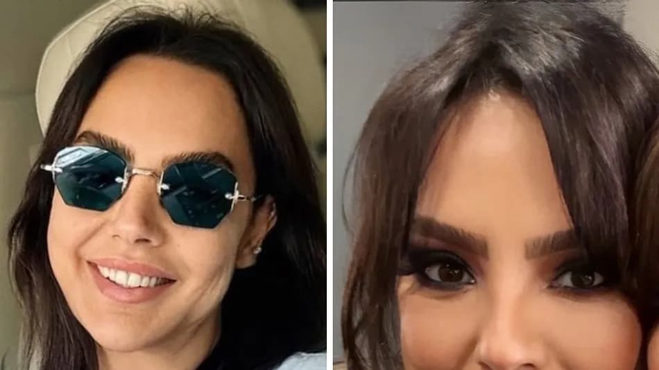 Ebru Gündeş yarım yüz gerdirme ameliyatı olduğunu açıkladı