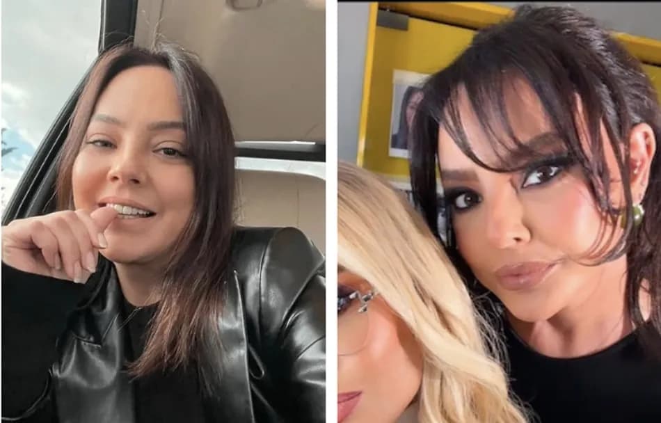 Ebru Gündeş geçirdiği yüz operasyonunu sahnede açıkladı