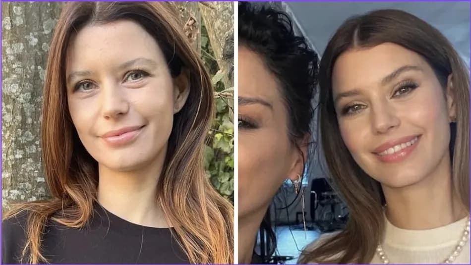 Beren Saat hakkında sosyal medyada estetik tartışması başladı
