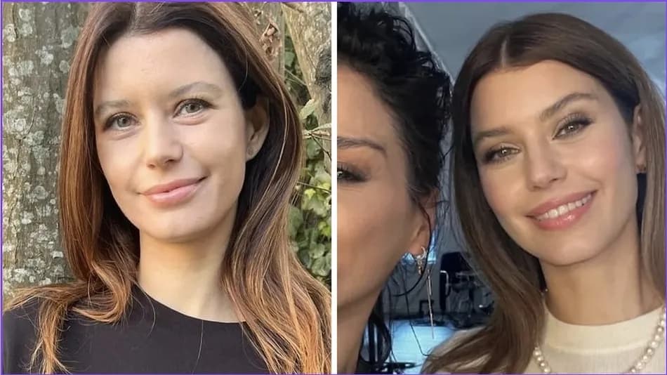 Beren Saat hakkında sosyal medyada estetik tartışması başladı