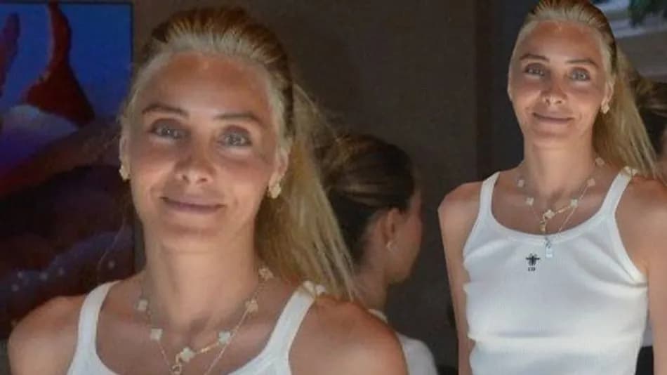 Nur Fettahoğlu'nun son hali sosyal medyada gündem oldu