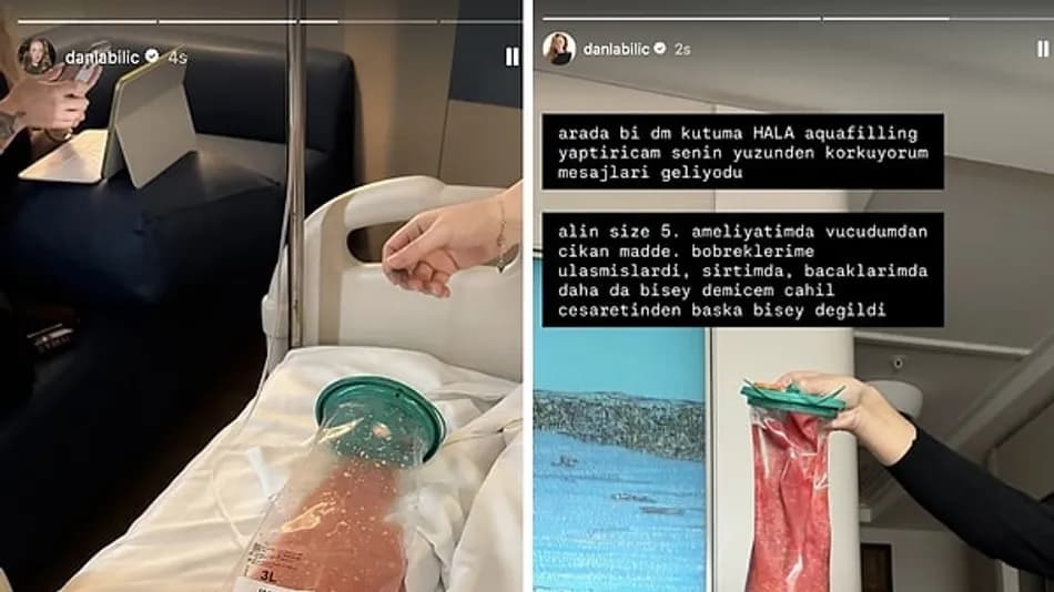 Danla Bilic acil ameliyata alındı: Aquafilling kabusu sürdü