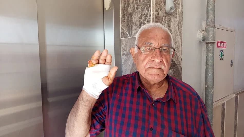 Hatay'da bir kişi komşusunun parmağını ısırarak kopardığı iddiasıyla gündeme geldi