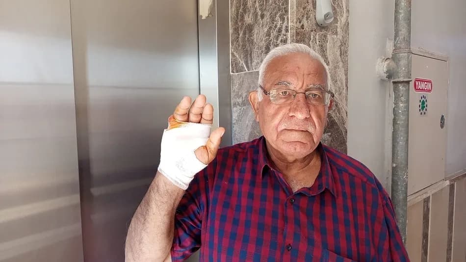 Hatay'da bir kişi komşusunun parmağını ısırarak kopardığı iddiasıyla gündeme geldi