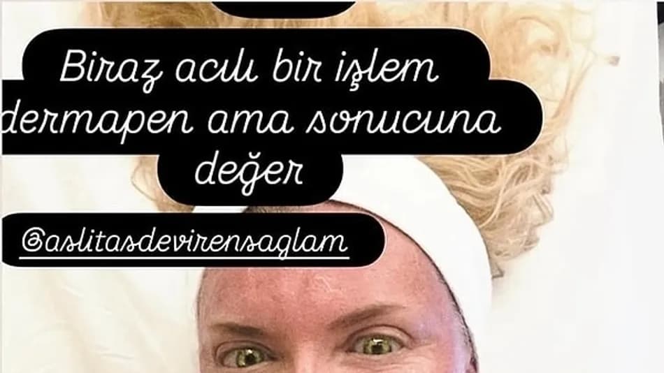 Biricik Suden estetik yorumlarına sert yanıt verdi