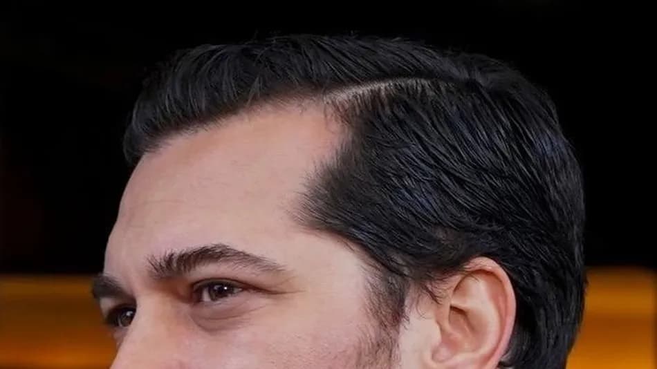 Çağatay Ulusoy’un fiziksel değişimi sosyal medyada gündem oldu