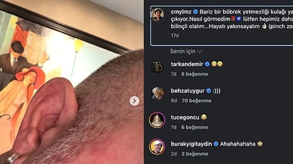 Cem Yılmaz’dan kulak çizgisi yorumlarına esprili yanıt