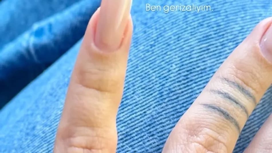 İrem Derici serçe parmağındaki değişimi paylaştı