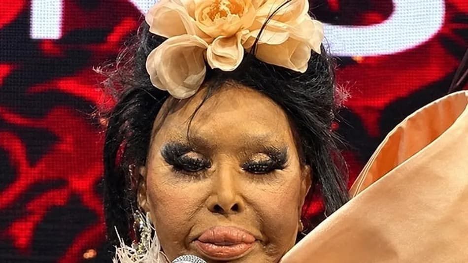 Bülent Ersoy’un Lolita Estetiği Sonrası Son Hali Gündem Oldu