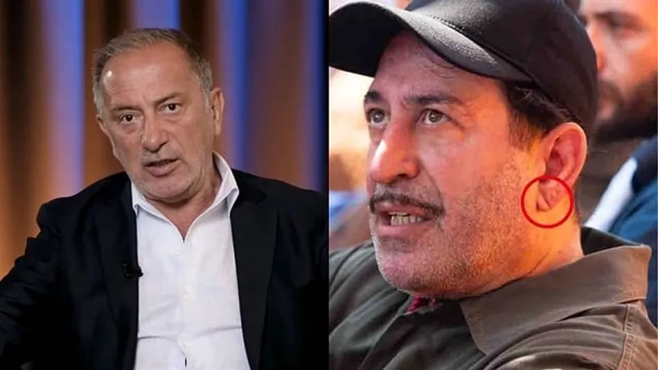 Cem Yılmaz’ın kalp krizi sonrası kulak çizgisi tartışması