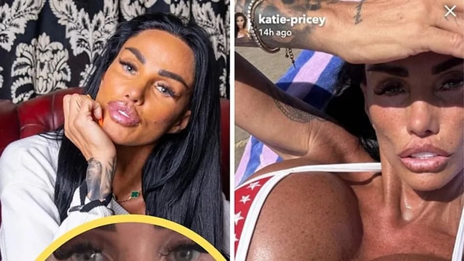 Katie Price 43 estetik operasyon sonrası yeniden gündemde