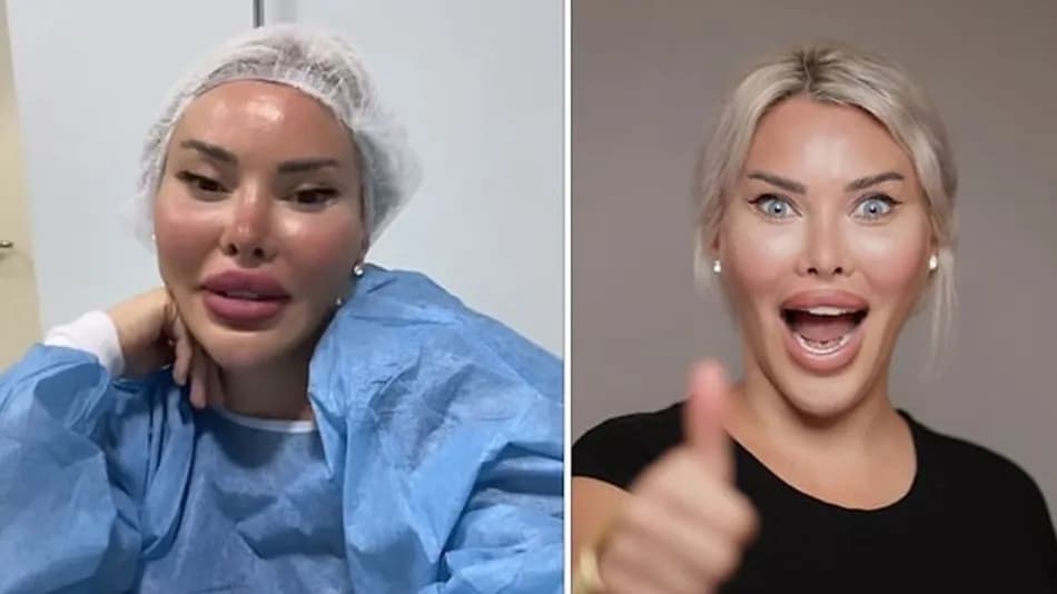 Pınar Özkurteller göz rengini maviye değiştirdi